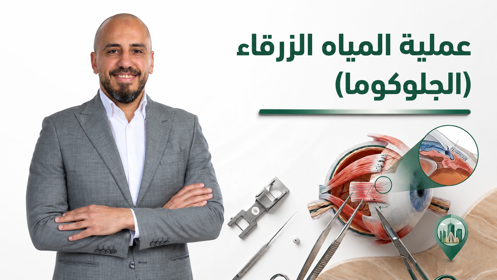 عملية المياه الزرقاء (الجلوكوما) 2026 | عيادة توفيق