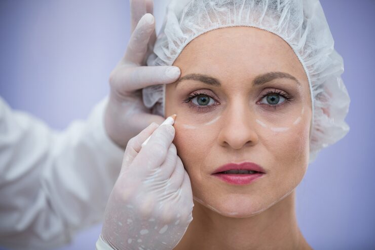 عملية تجميل الجفون
